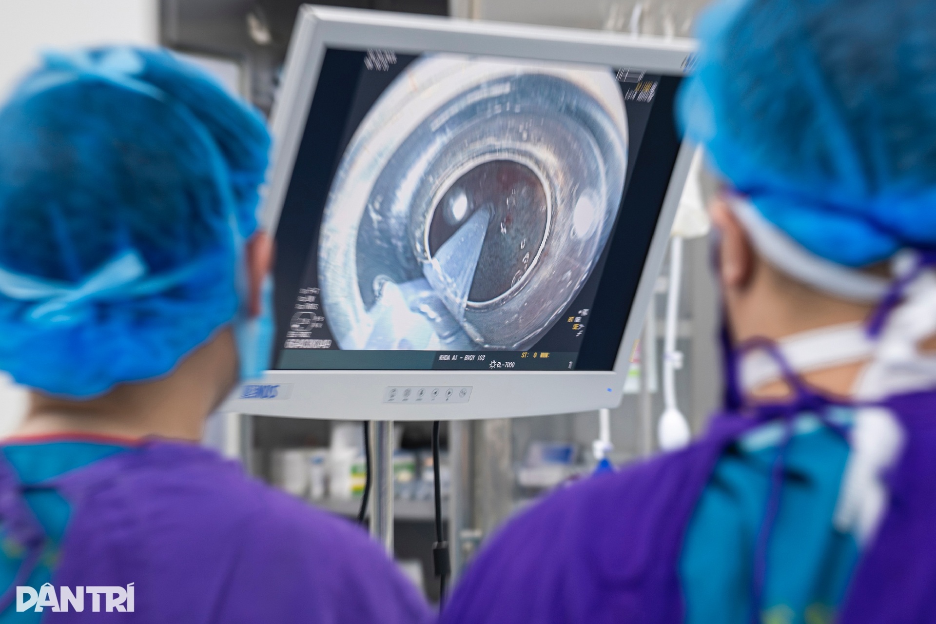 Xem bác sĩ thâm nhập dạ dày truy vết ung thư - 6