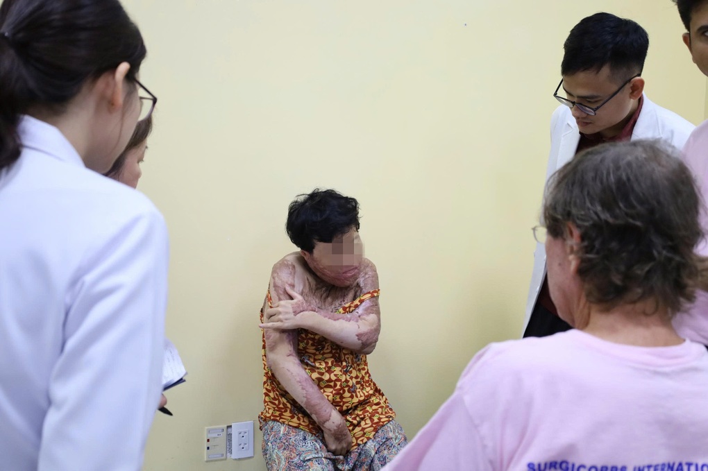 Chàng trai hóa “ngọn đuốc sống” vì hút thuốc khi đổ xăng, đi mổ hơn 20 lần - 5