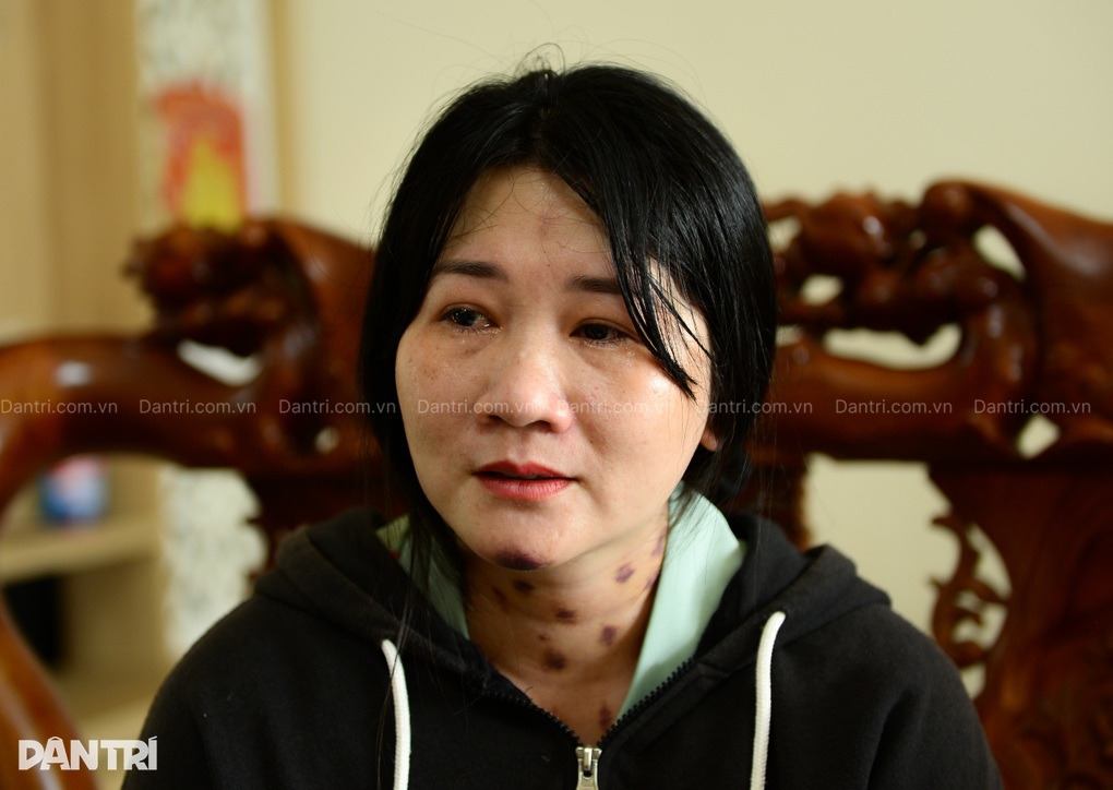 Người mẹ khẩn cầu cứu con trai 10 tuổi mắc ung thư giữa cảnh sắp mất nhà - 2