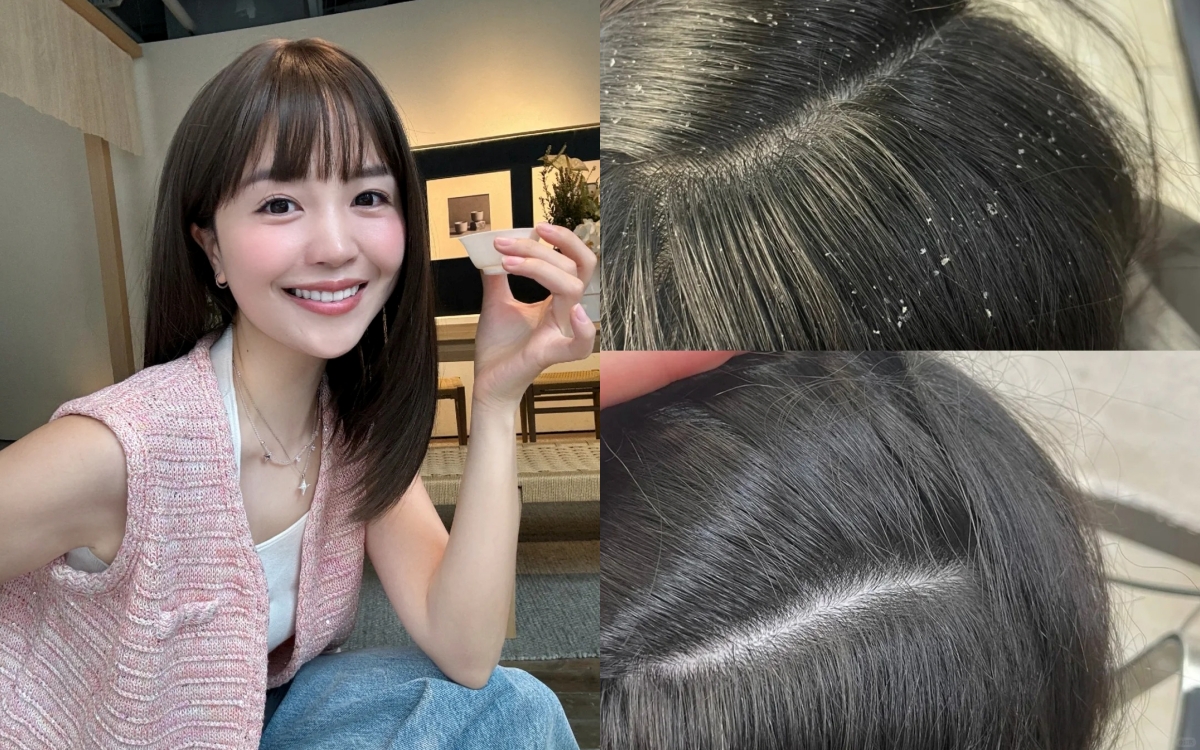 5 dầu gội đặc trị gàu, làm sạch sâu tận chân mà không gây khô tóc - Ảnh 1.