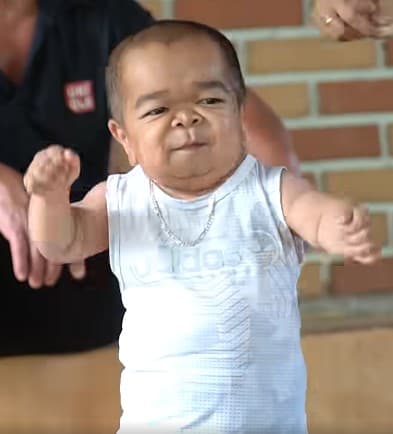 đàn ông thấp bé 0 đàn ông thấp nhất Việt Nam, người đàn ông thấp nhất Việt Nam, anh Lưu ở Sơn La, kiến thức