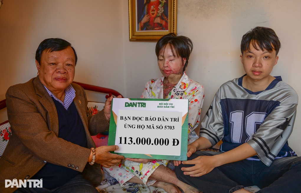 Bạn đọc hỗ trợ người phụ nữ bị bỏng axit ở Lâm Đồng 176 triệu đồng - 1