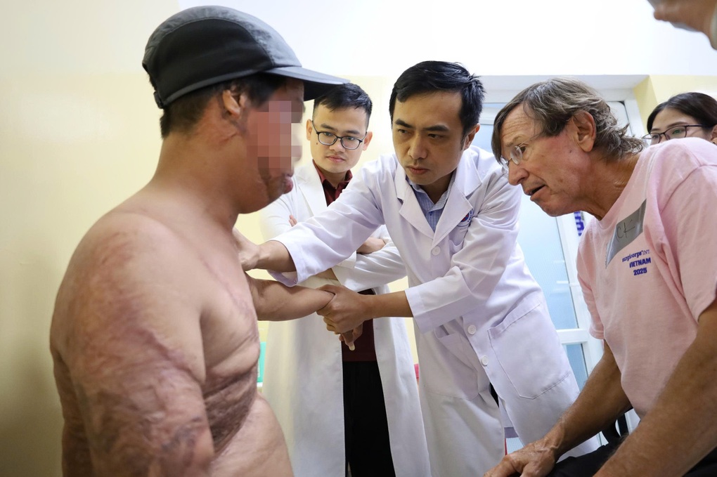 Chàng trai hóa “ngọn đuốc sống” vì hút thuốc khi đổ xăng, đi mổ hơn 20 lần - 4