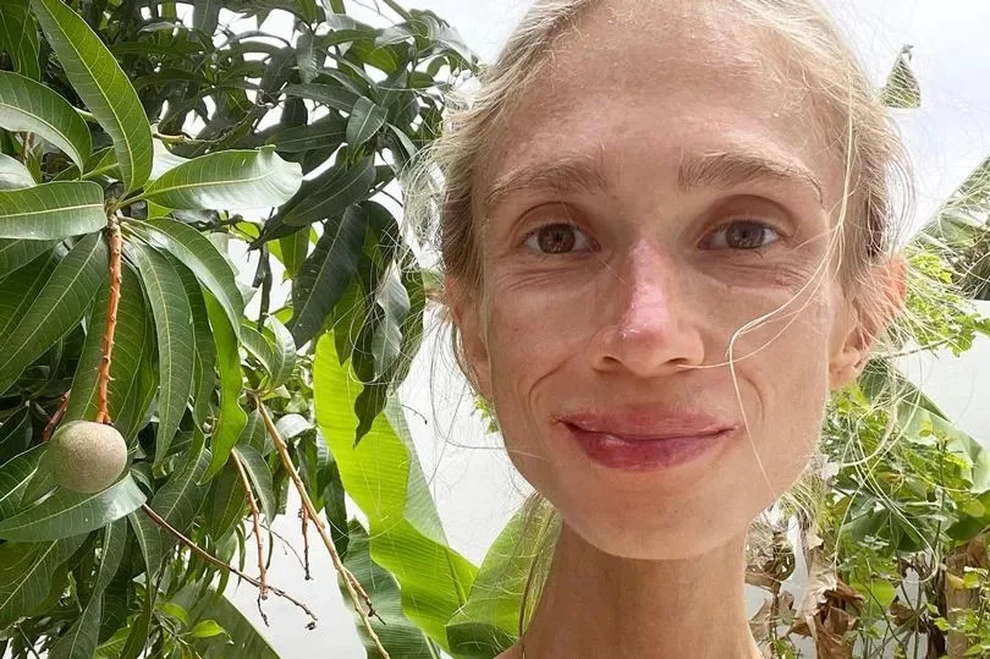 Cô gái bị phát hiện chết đói ở khách sạn: Chỉ ăn trái cây, cơ thể nặng 22kg - 1