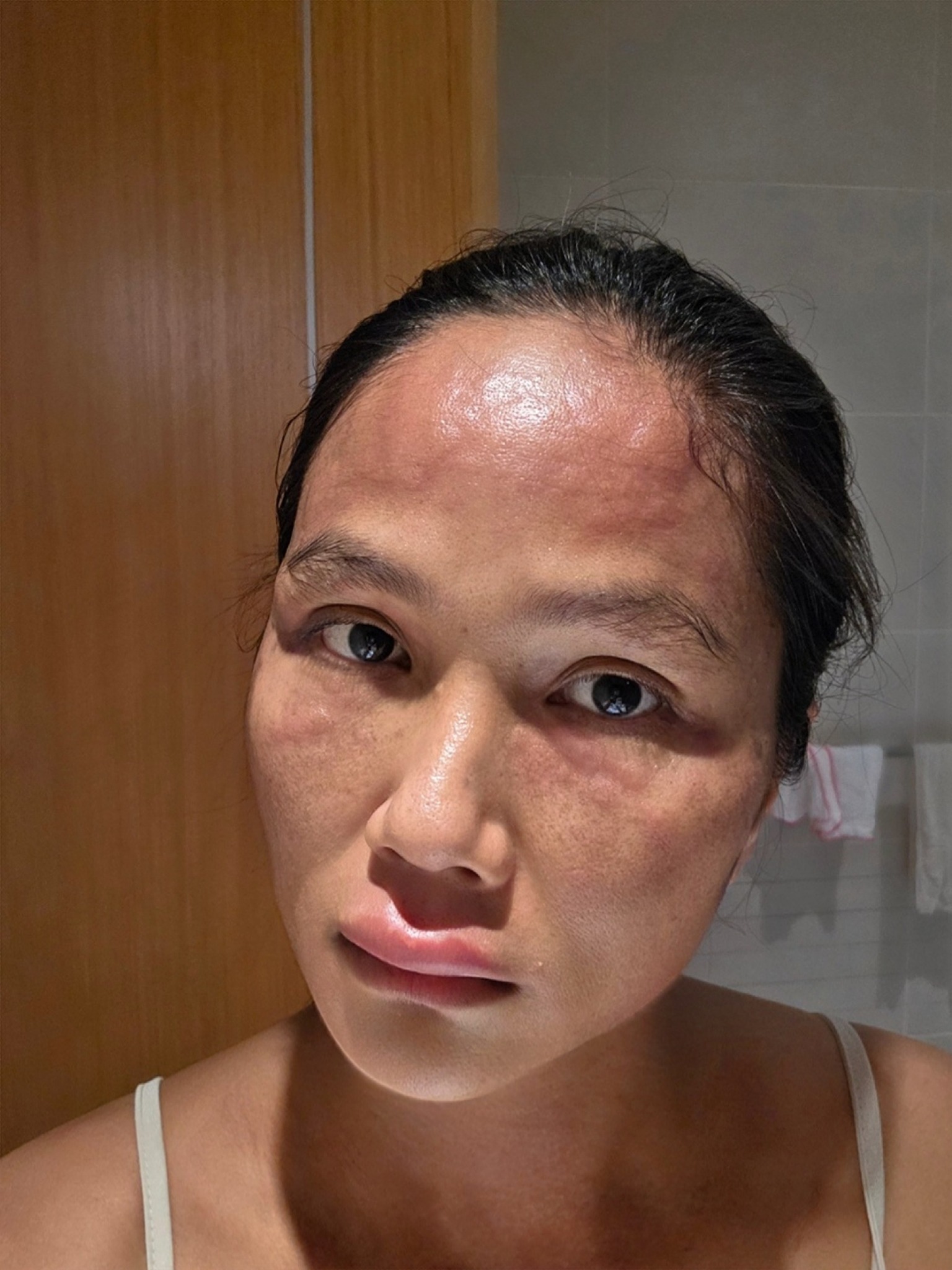 Gương mặt biến dạng sau sinh của H'Hen Niê- Ảnh 1.