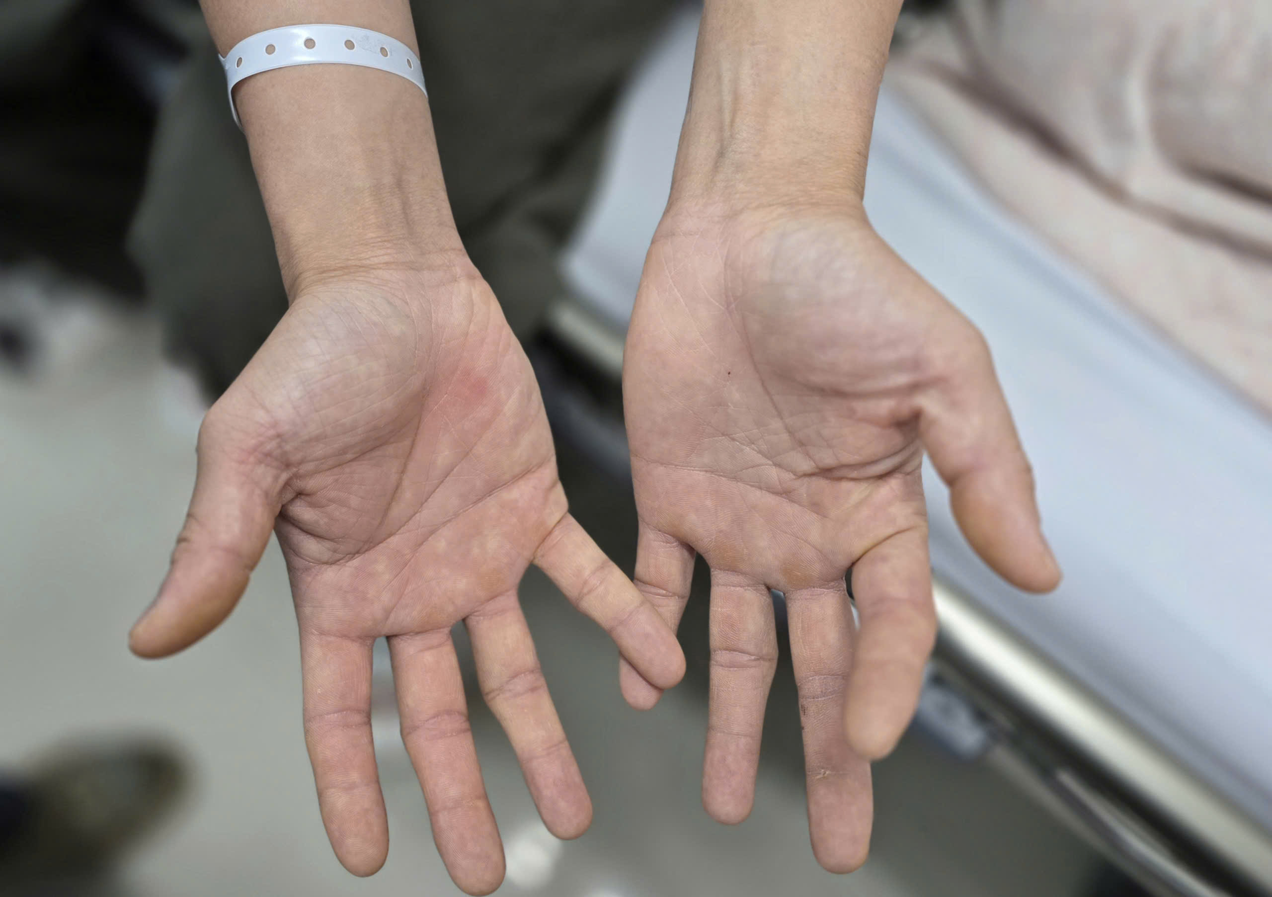 bóng cười - Ảnh 1.