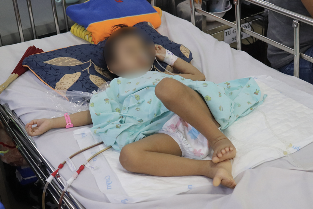 Hy hữu bé gái bị cành cây đâm xuyên hậu môn, nằm trong bụng suốt 4 tháng - 1