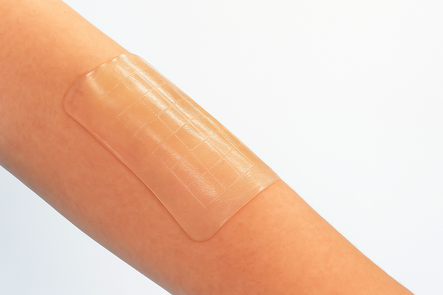 Keo sinh học dán kín vết thương chỉ trong 5 giây - Ảnh 1.