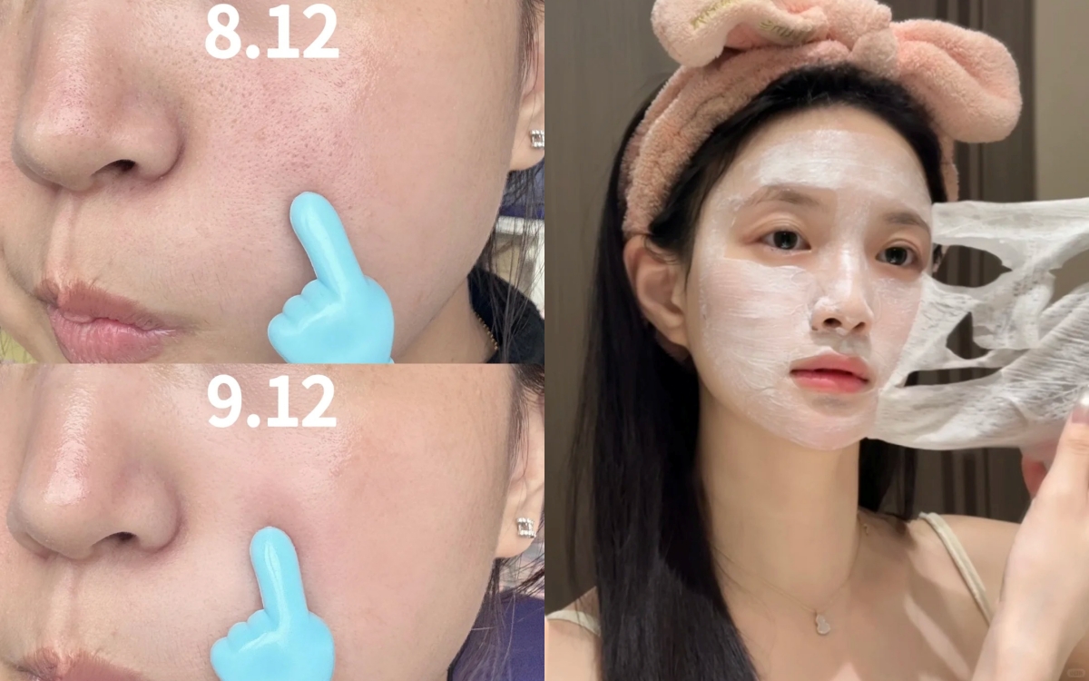 Lỗ chân lông từ to hóa nhỏ, mụn đầu đen biến mất khi đắp loại mặt nạ này mỗi tuần - Ảnh 1.