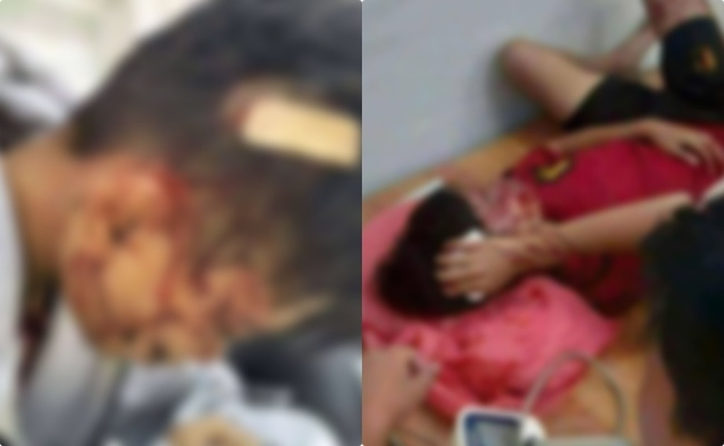 Loạt vụ học sinh đánh nhau nhập viện, hiệu trưởng phải chịu trách nhiệm - 2