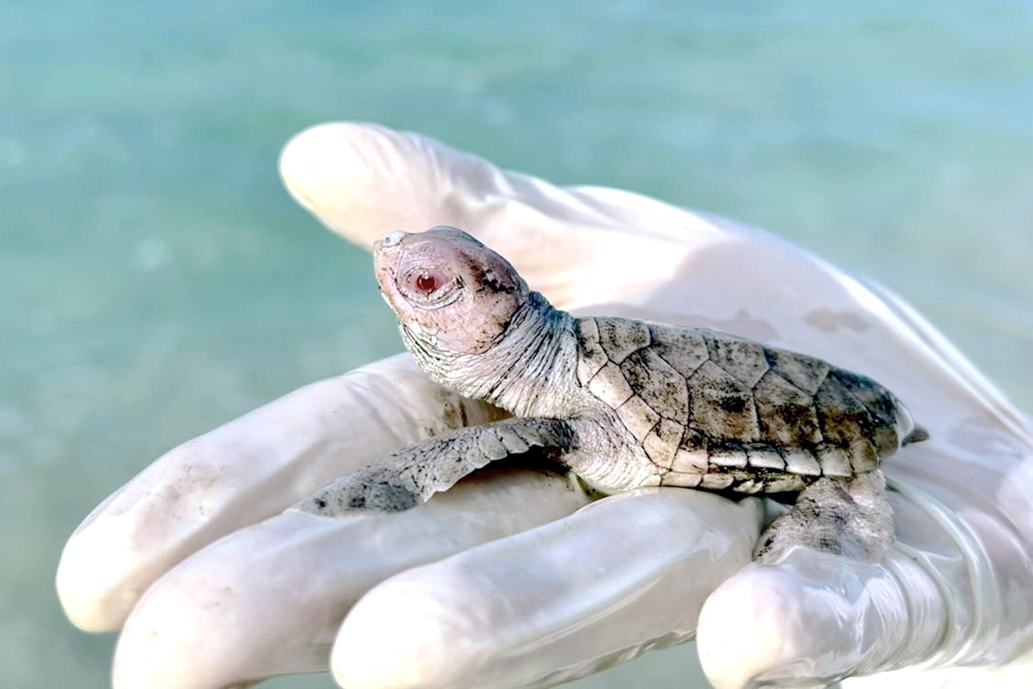 bạch tạng - Ảnh 1.