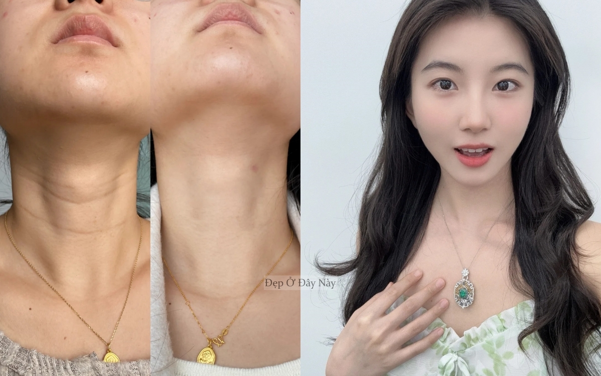 Bí kíp của phụ nữ Trung Quốc: Chỉ 15 phút mỗi ngày để "là phẳng" nếp nhăn vùng cổ - Ảnh 1.