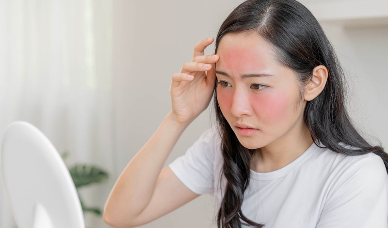  
Tia UV là kẻ thù thầm lặng, khiến làn da mụn yếu đi từng chút một. (Nguồn: Shutterstock)