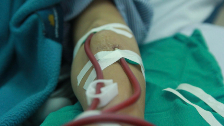 D. duy trì sự sống phụ thuộc vào những đường dây qua cầu tay chạy thận. Ảnh: P.Thúy.