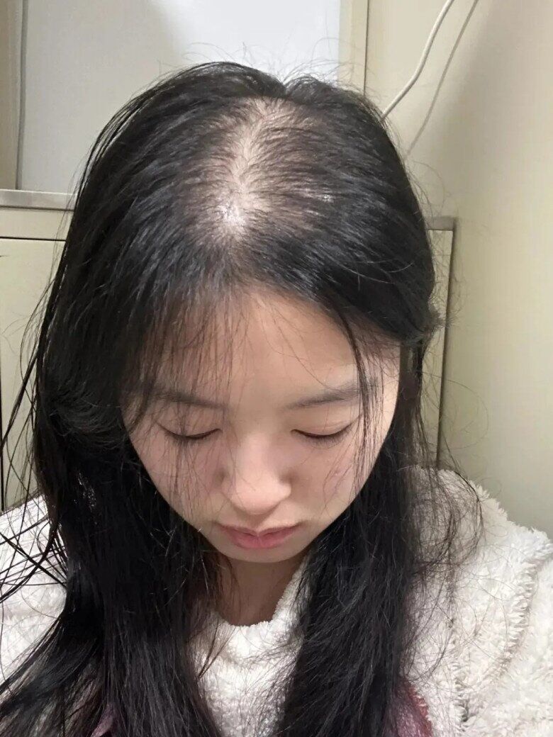 Tóc mọc chậm mãi không dài lại hay rụng nhiều, thử ngay bí quyết giúp tóc dài gấp đôi trong 1 tháng của gái Hàn - 1