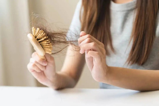 Tóc rụng lả tả chưa chắc là do thiếu chất, 4 thói quen vô tình này khiến tóc của bạn rụng nhiều hơn, điều thứ 3 lắm người mắc nhất- Ảnh 1.