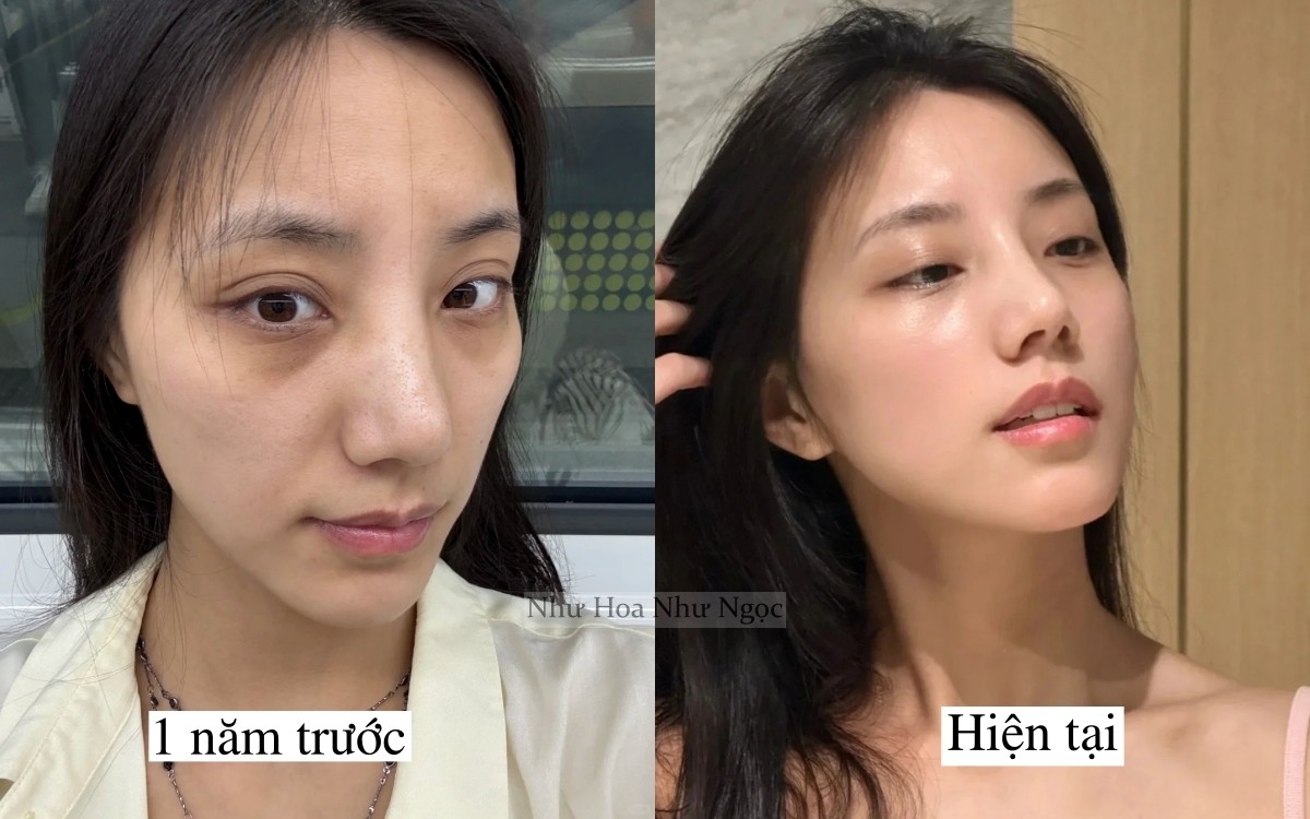 Tôi lấy lại làn da tuổi 20 nhờ 1 năm ngủ sớm, ăn lành và chăm da đúng cách - Ảnh 1.