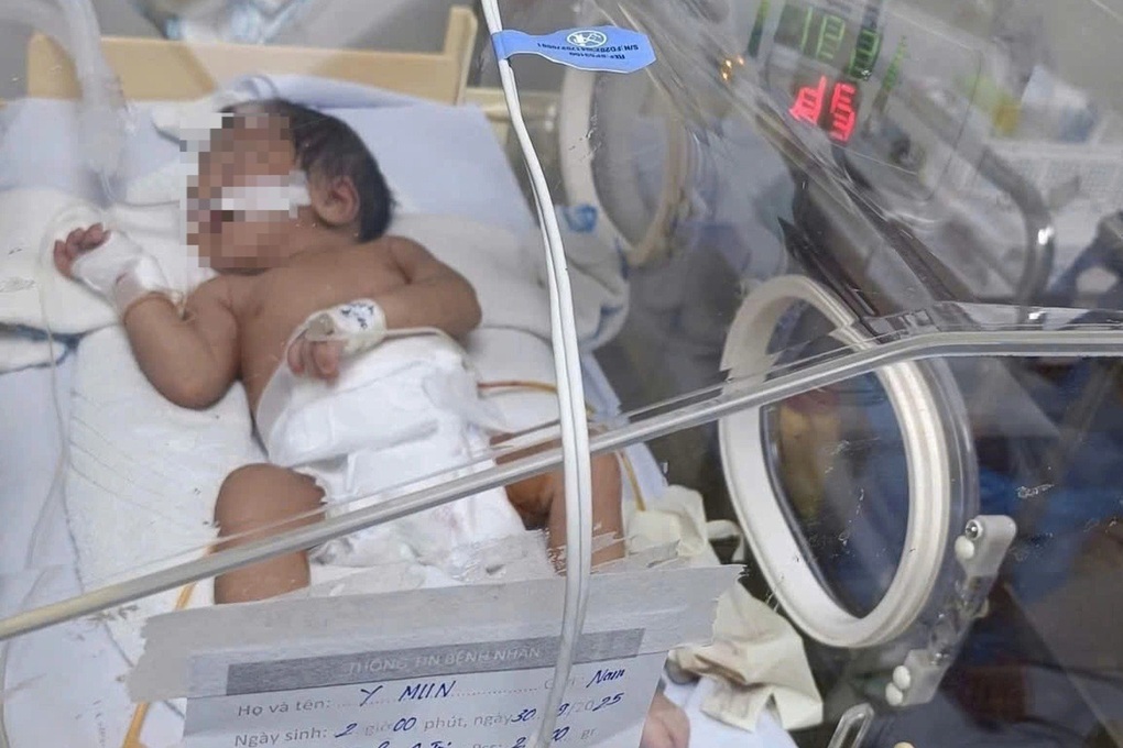 Vụ bé 5 ngày tuổi thủng dạ dày: Bác sĩ cảnh báo nguy cơ ăn dặm sớm - 1