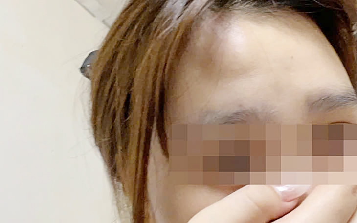 hành hung - Ảnh 1.