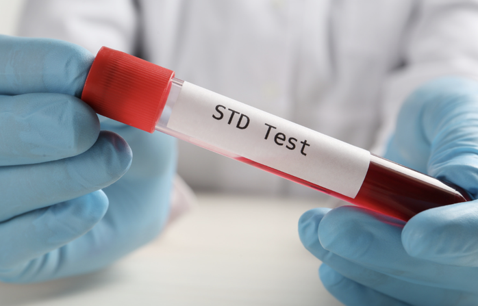 Tại Việt Nam, số liệu giai đoạn 2020-2023 cho thấy số ca mắc bệnh lây truyền qua đường tình dục tăng ở nhiều nhóm