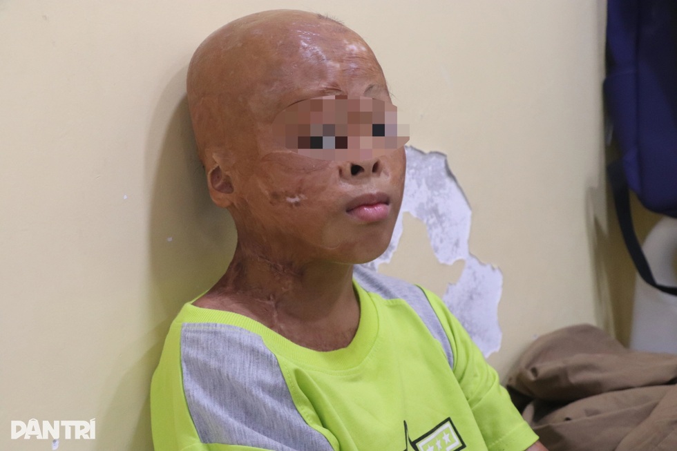 Những ca mổ “0 đồng” giúp hàng trăm người tìm lại hình hài sau biến cố - 3