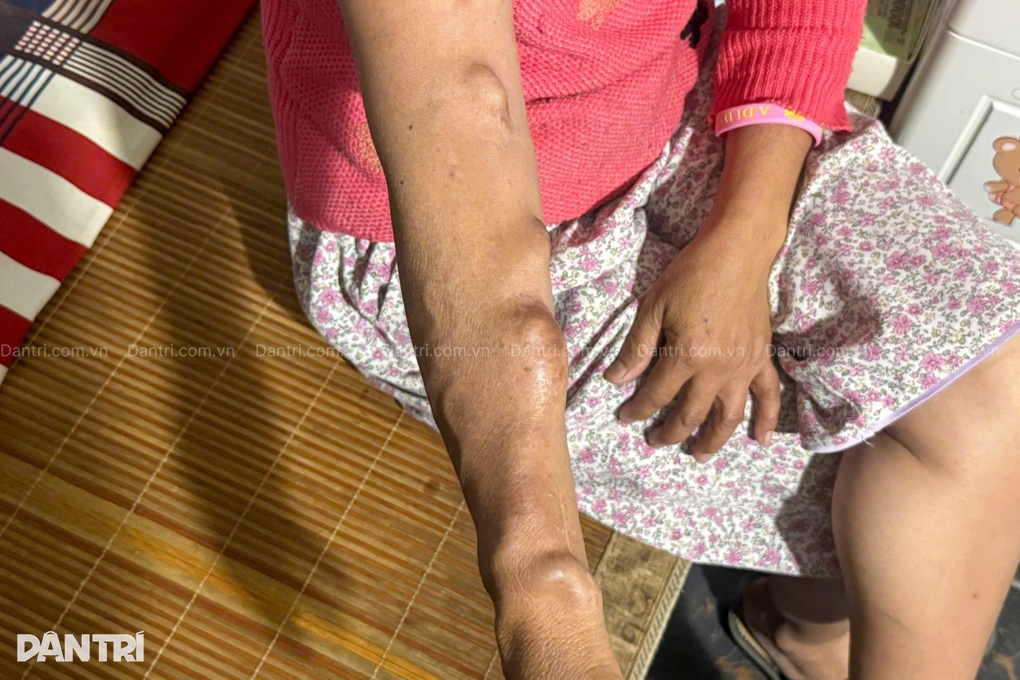 Người phụ nữ nghèo 13 năm bệnh nặng, mong được sống để báo hiếu mẹ - 3