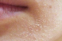 Làn da vào thu: Khi dưỡng ẩm trở thành 'chìa khóa' vàng