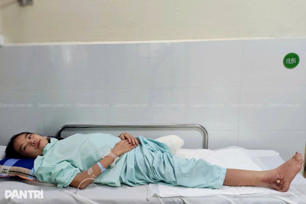 Bác sĩ kêu gọi giúp đỡ người mẹ dân tộc Mông phải cắt chân để giữ mạng sống - 2