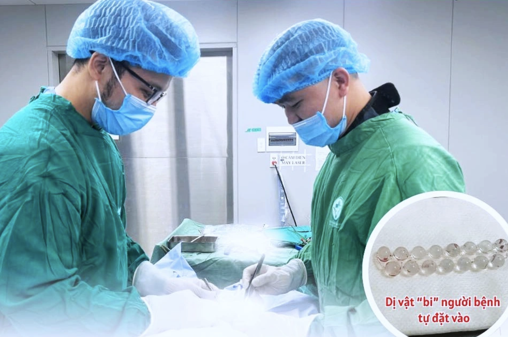 Trai trẻ rước họa vào thân vì tìm cách “tăng khoái cảm” phản khoa học - 3