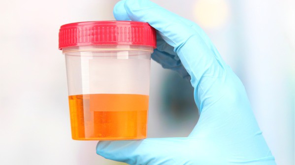 Thấy nước tiểu có 5 dấu hiệu này coi chừng gan đang "kêu cứu" - 2