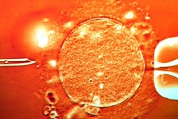 Người hiến tinh trùng mang gene ung thư khiến 10 trẻ mắc bệnh