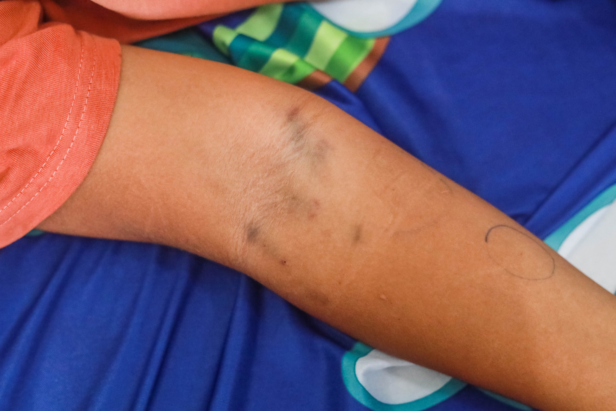 Con muốn sống: Bé trai ung thư 'xin mẹ sinh em khác để con được chết'- Ảnh 3.