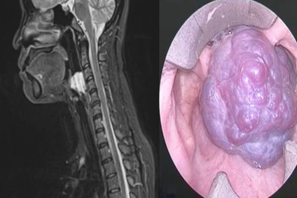 Bác sĩ Việt báo cáo ca bệnh hiếm gặp, y văn ít đề cập - 2