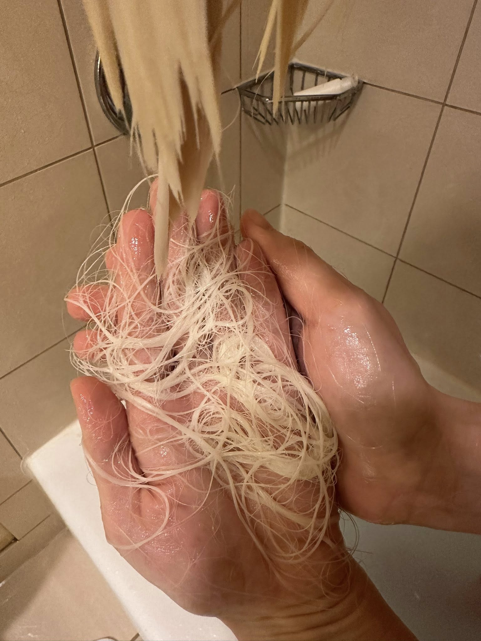 Nữ DJ suy sụp bật khóc, tóc rụng mảng lớn- Ảnh 2.