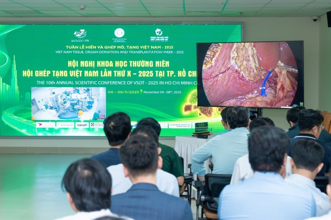 Ca mổ được truyền hình trực tiếp tới hội trường hội nghị, thu hút sự chú ý của các chuyên gia trong và ngoài nước. Ảnh: Vinmec