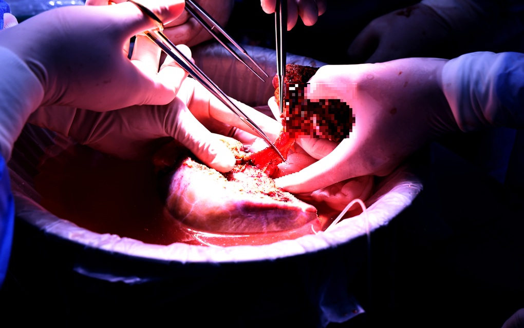 Món quà để lại dương thế của người quân nhân hồi sinh 6 cuộc đời - 2