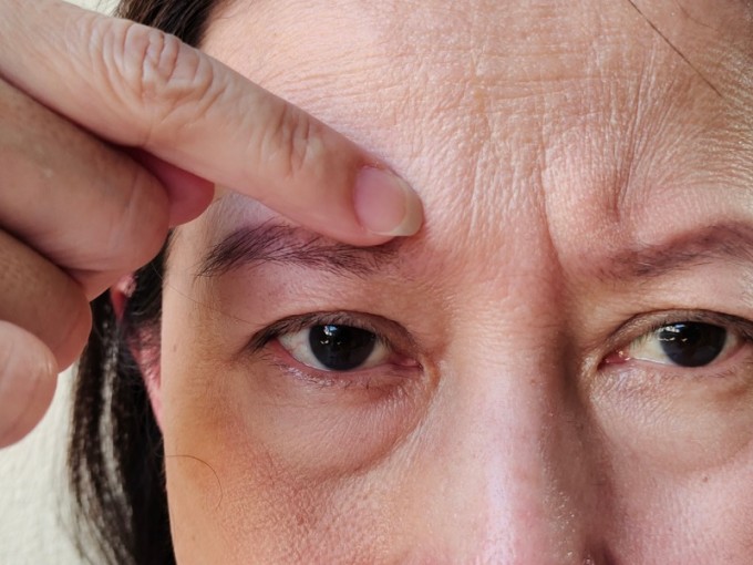 Thiếu ngủ lâu ngày khiến da xỉn màu, lão hóa sớm.