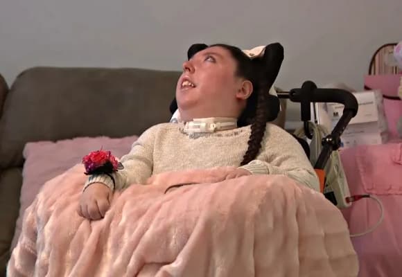 Alex Simpson, hội chứng hydranencephaly, Cô bé sinh ra không có não