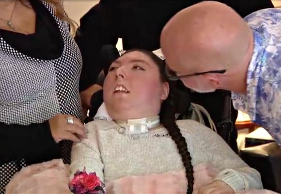 Alex Simpson, hội chứng hydranencephaly, Cô bé sinh ra không có não