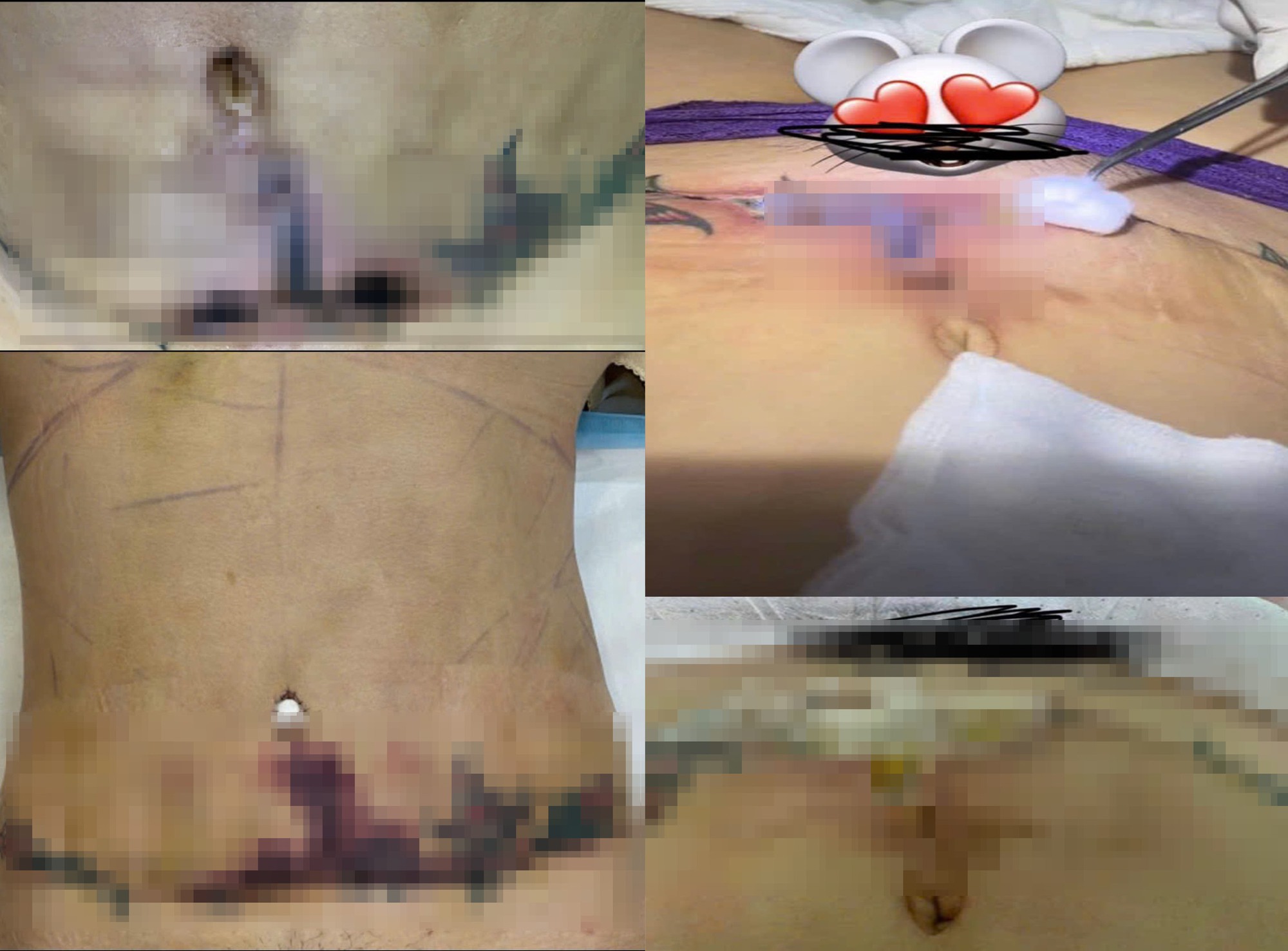 Sau điều tra Góc khuất 