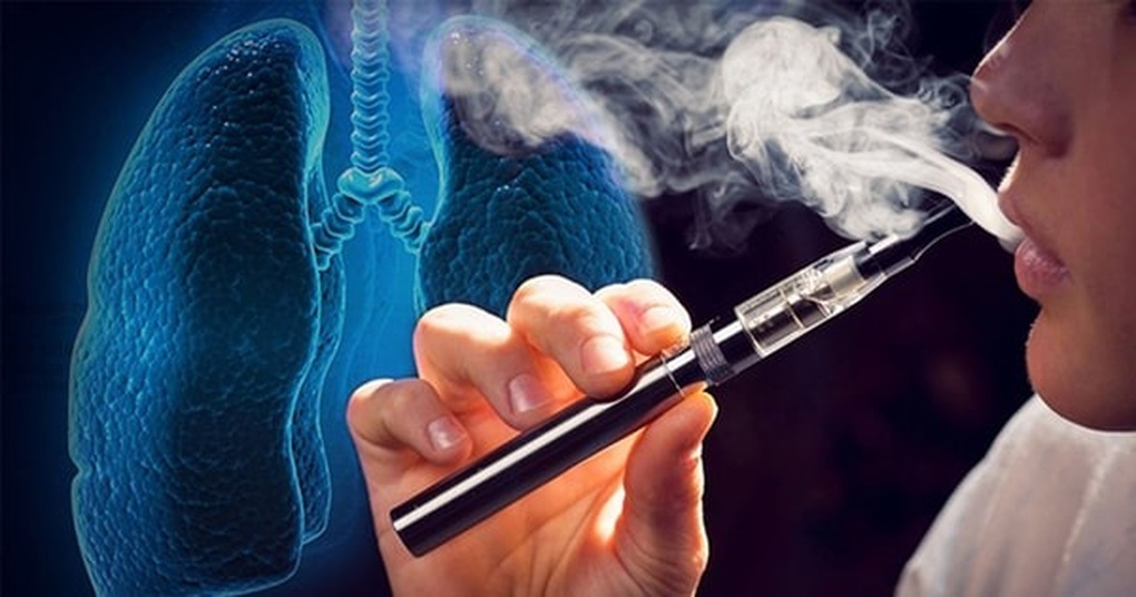 Hàng ngàn hợp chất chưa xác định trong vape hé lộ mặt tối ít ai biết - 2