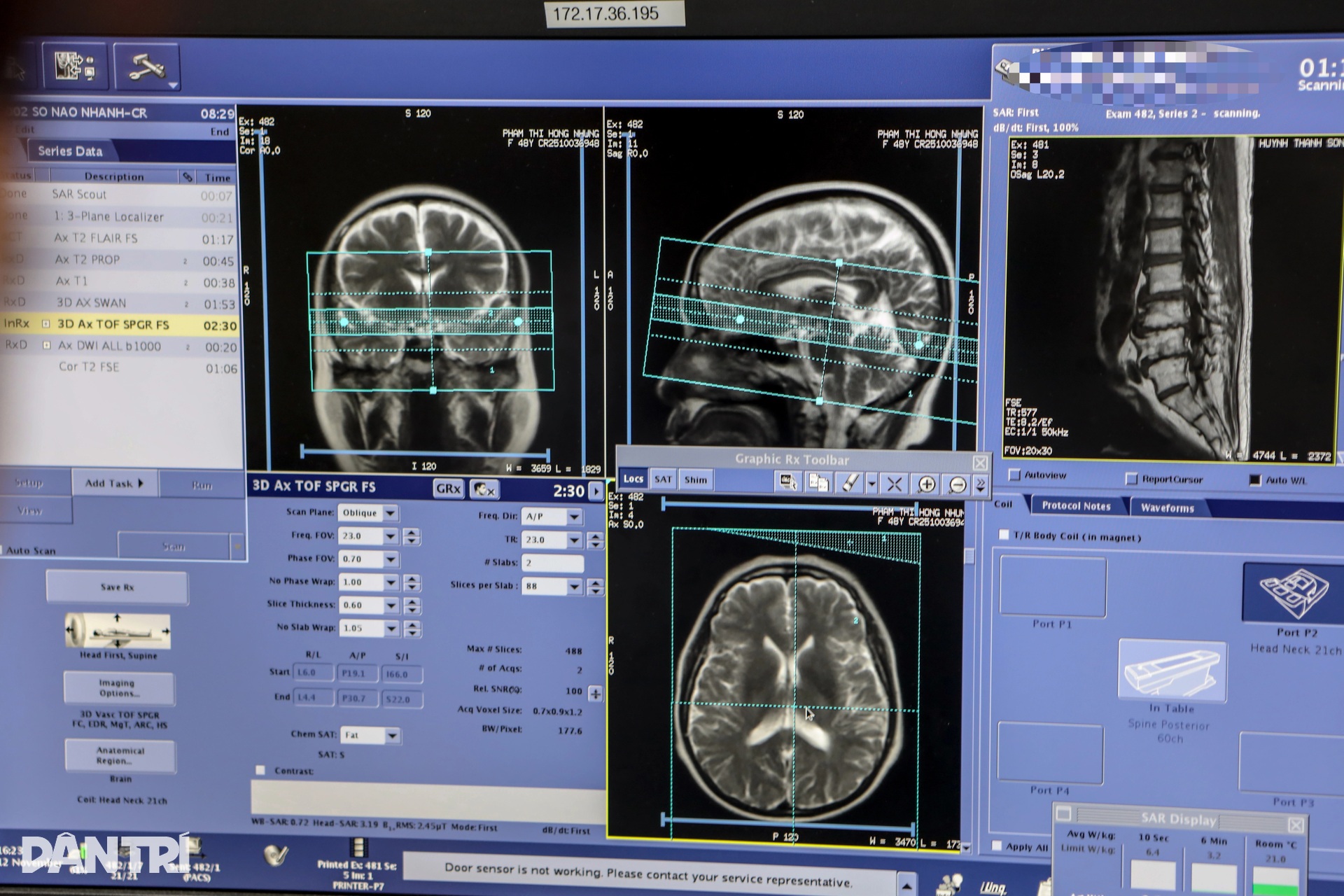 Chợ Rẫy vận hành máy MRI hiện đại nhất phía Nam, chụp nhanh gấp đôi - 3