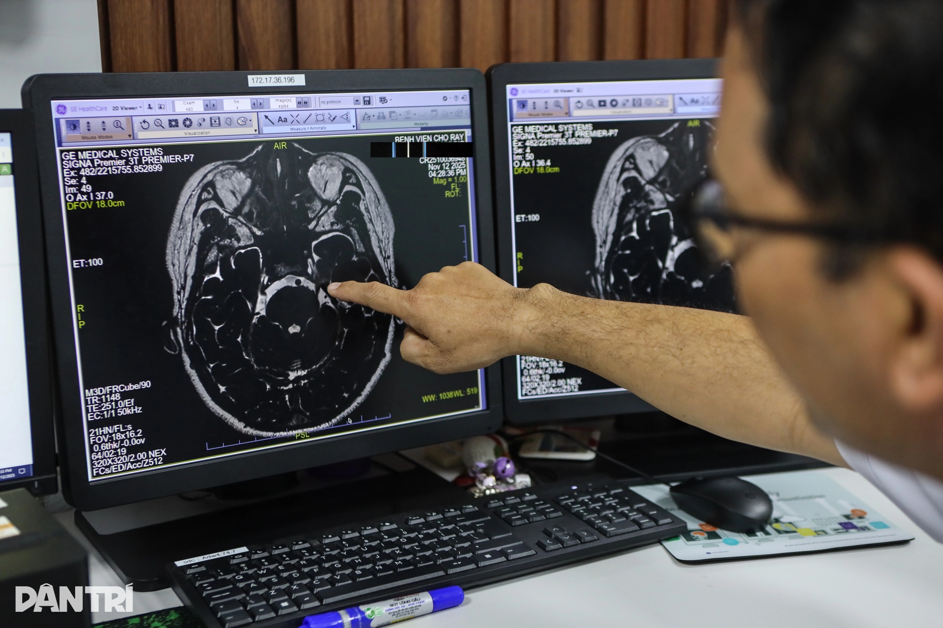 Chợ Rẫy vận hành máy MRI hiện đại nhất phía Nam, chụp nhanh gấp đôi - 4