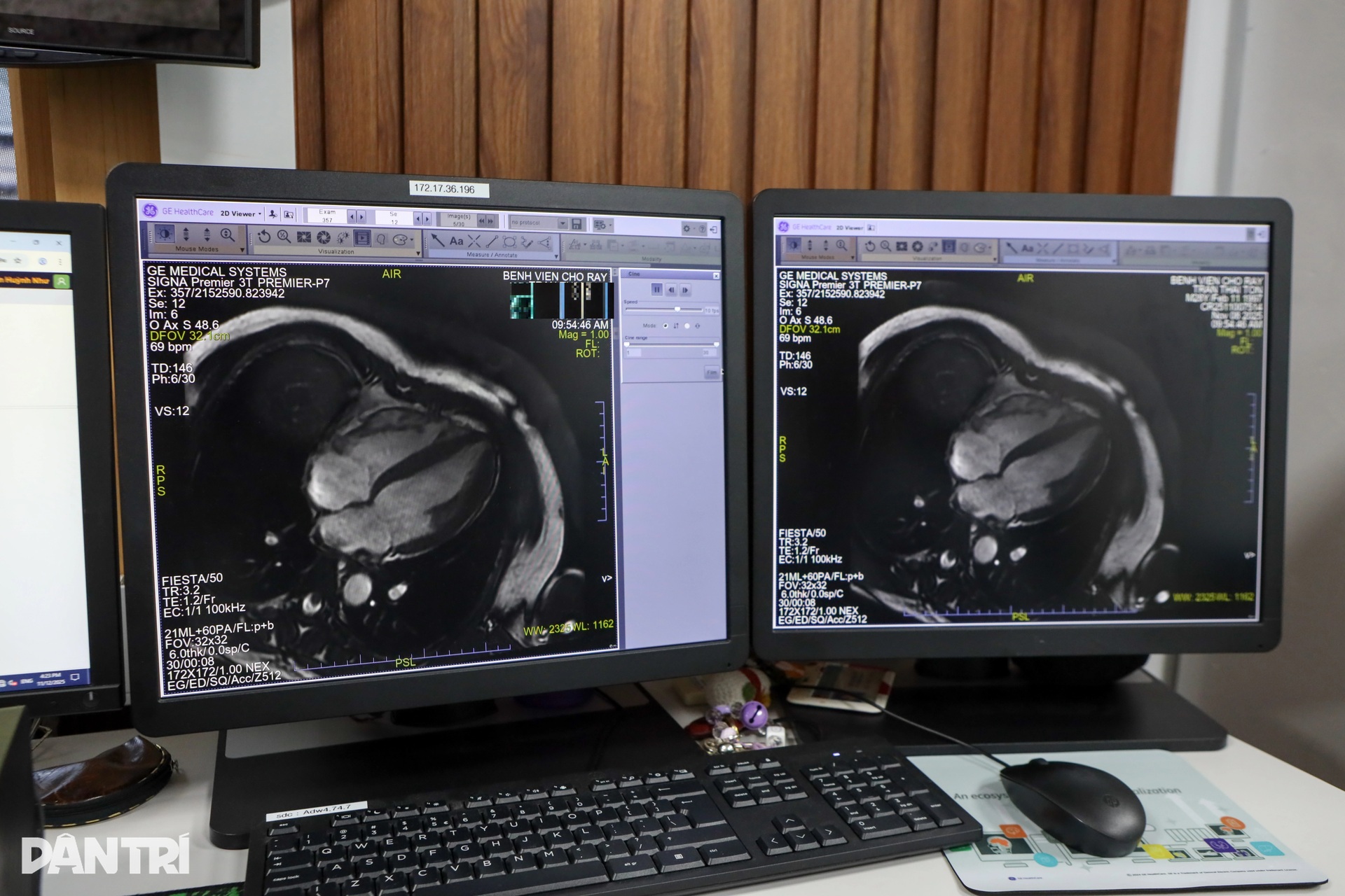 Chợ Rẫy vận hành máy MRI hiện đại nhất phía Nam, chụp nhanh gấp đôi - 5