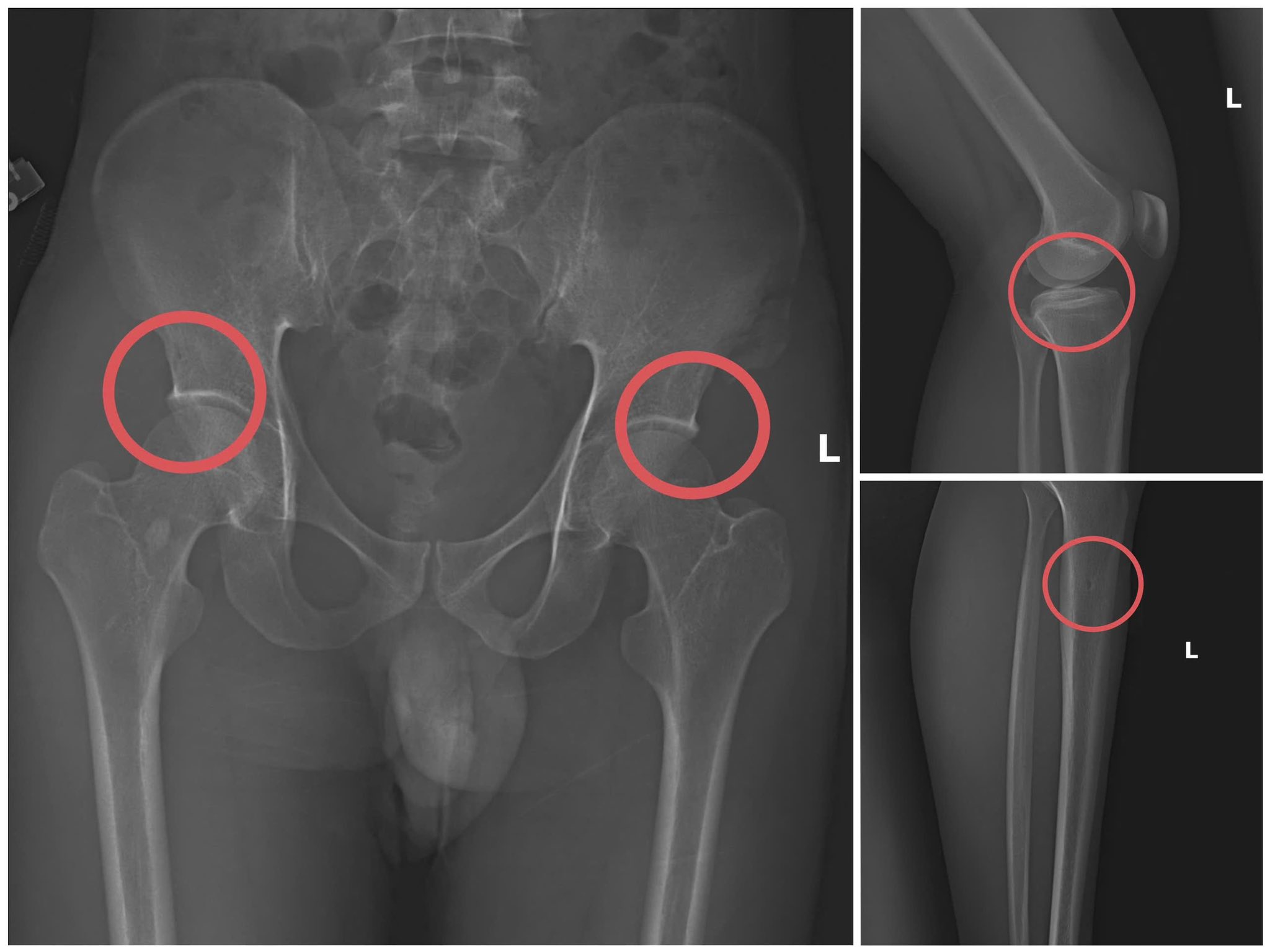 Cựu cán bộ y tế cầm đầu đường dây chuyên dùng búa đập vỡ xương, chiếm đoạt tiền bảo hiểm 2 Nguyên cán bộ y tế, cầm đầu đường dây chuyên dùng búa đập vỡ xương, chiếm đoạt tiền bảo hiểm - Ảnh 2.