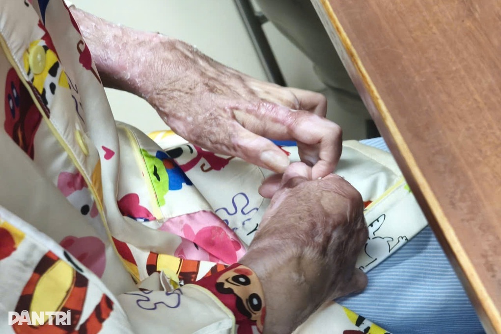 Thiếu nữ 17 tuổi bị bạn đốt keo nến làm cháy khắp người, phải mổ 15 lần - 2