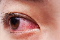 Dấu hiệu ở mắt tiết lộ 10 căn bệnh tiềm ẩn nguy hiểm