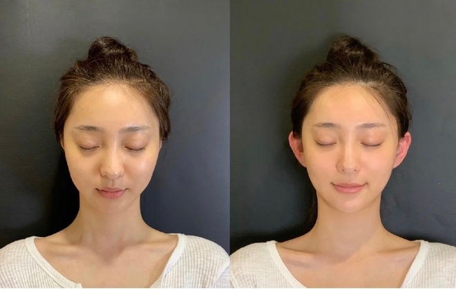 Cô gái khổ sở 30 năm vì tai giống Đoàn Di Băng- Ảnh 5.