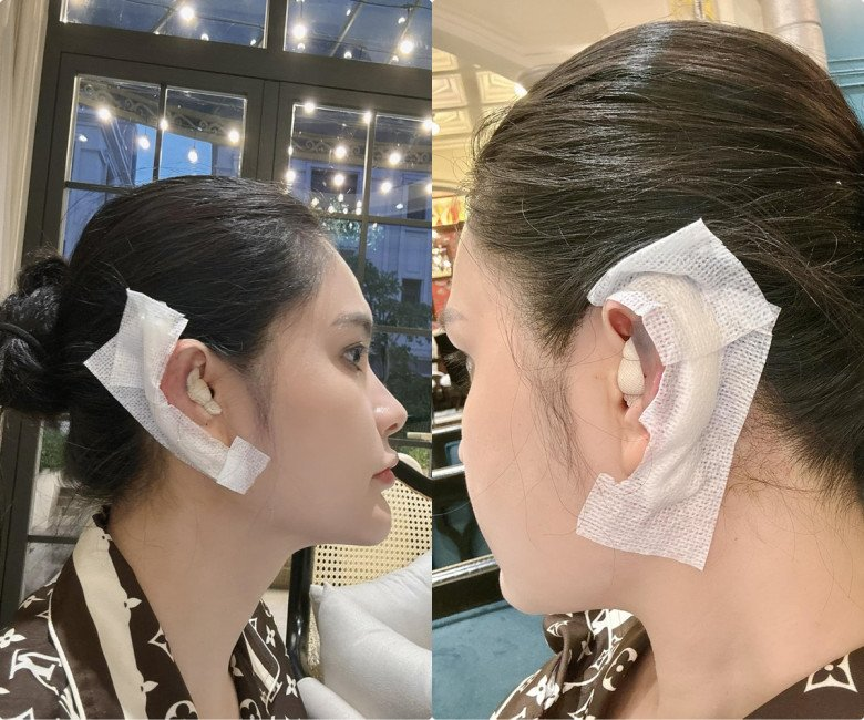 Cô gái khổ sở 30 năm vì tai giống Đoàn Di Băng- Ảnh 9.