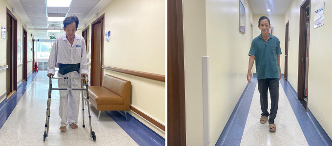 Ông Niên tự đi lại trước khi xuất viện (trái) và khi tái khám. Ảnh: Bệnh viện Đa khoa Tâm Anh